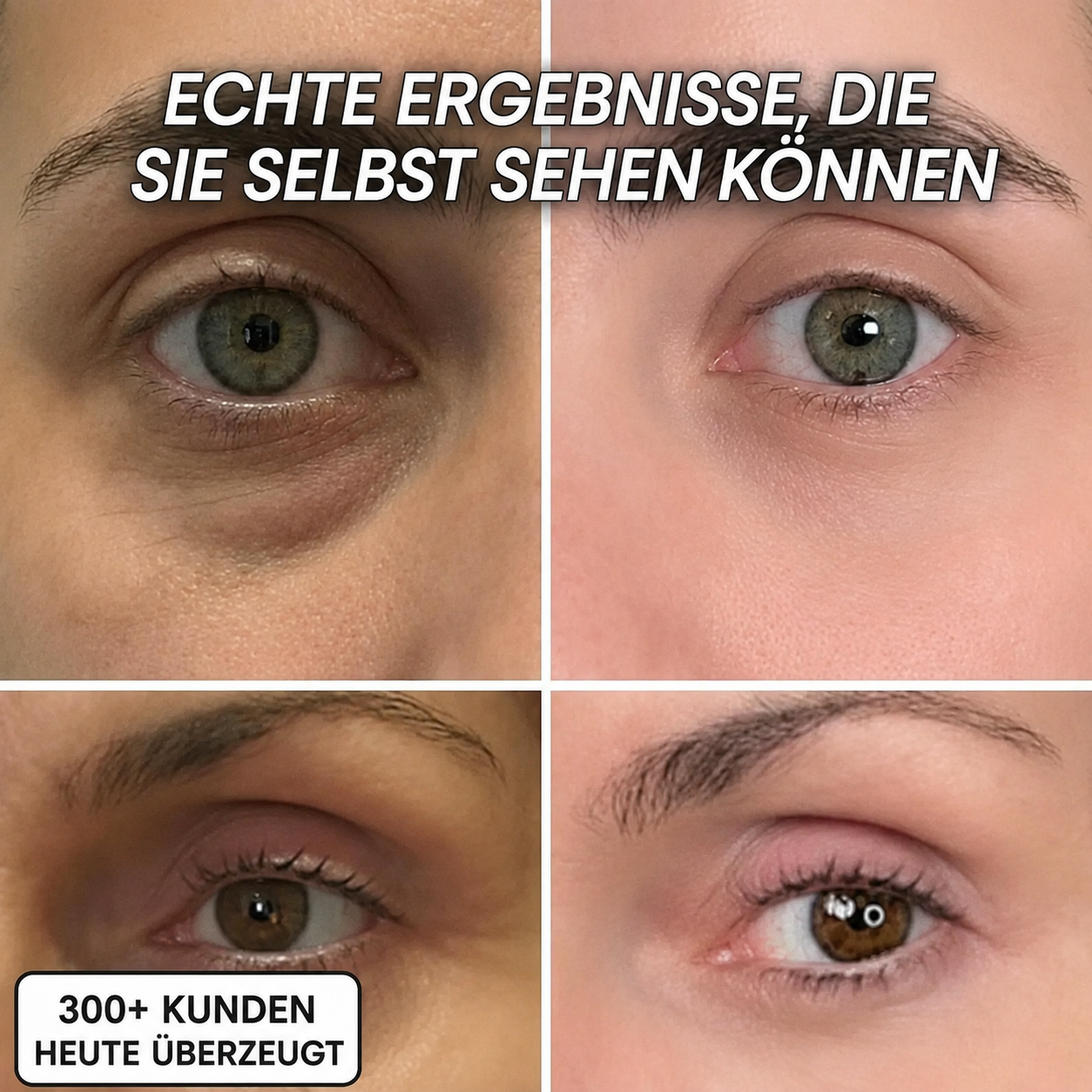 Bio-Kollagen PDRN Aufpolsternder Stick