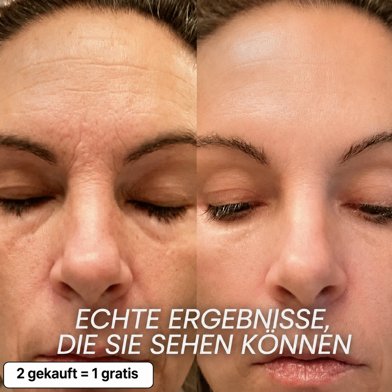 Bio-Kollagen PDRN Aufpolsternder Stick